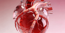 Coronary Artery Bypass Grafting (CABG)