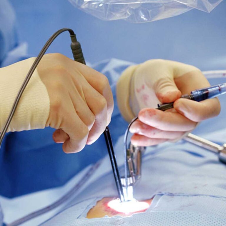 Minimally Invasive Cardiac Bypass Surgery